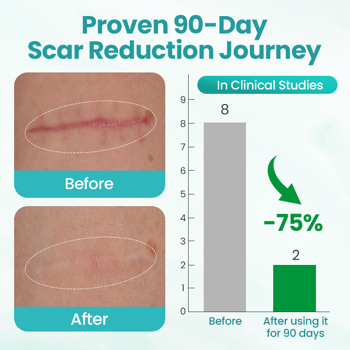 Timilk® EliteAloe ScarSolve Spray