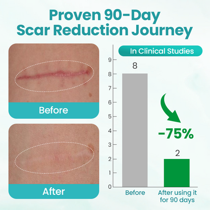 Timilk® EliteAloe ScarSolve Spray